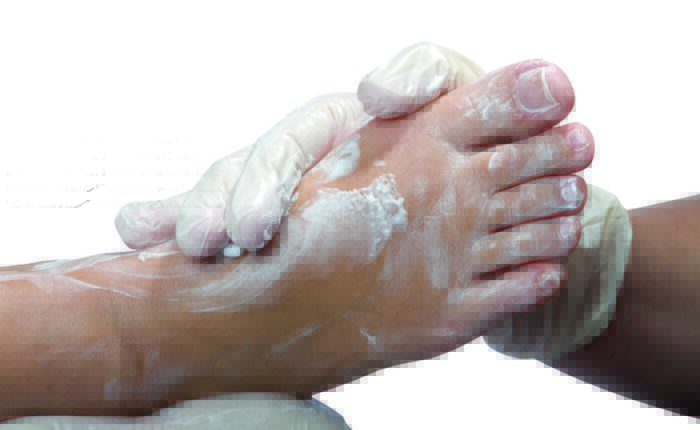 Schmierfuß frei 300dpi